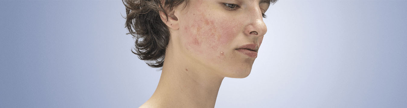 Skincare-for-maskne_3